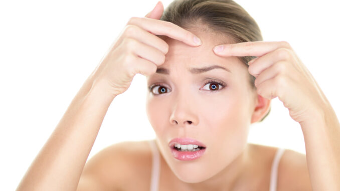 Mitesser loswerden: Der komplette Hautpflege-Fahrplan für Zuhause