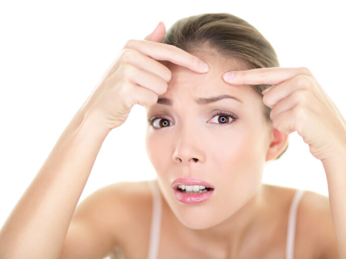 Mitesser loswerden: Der komplette Hautpflege-Fahrplan für Zuhause